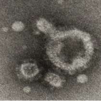 metapneumovirus